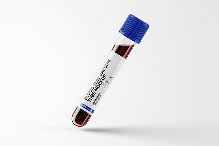 Blood Test Tube Mockup Template