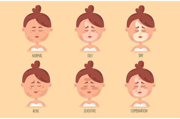 Girl Skin Types Cartoon Illustration